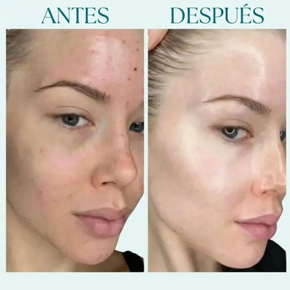 CollagenGlow™ – Mascarilla hidratante