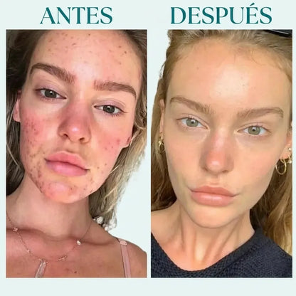 CollagenGlow™ – Mascarilla hidratante