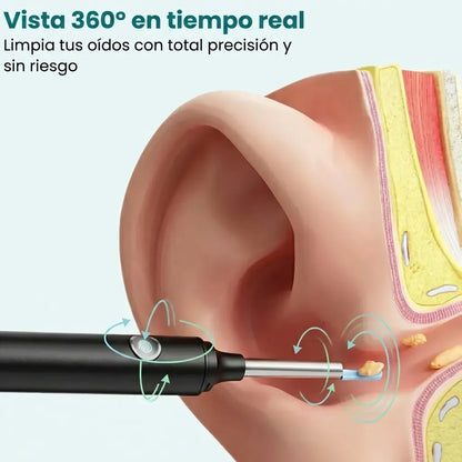 OryaneCam™: limpiador de oídos inteligente