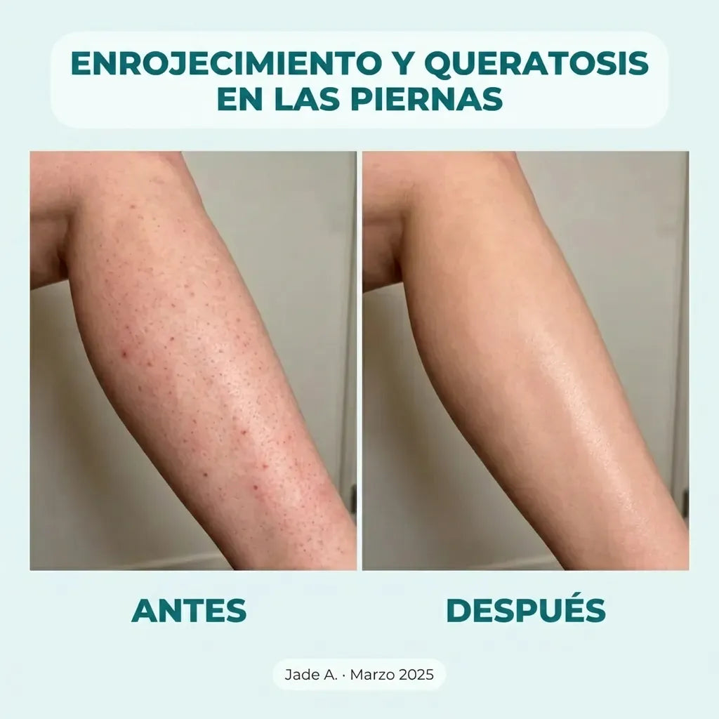 SkinEase™ – Maquinilla de afeitar 5 en 1