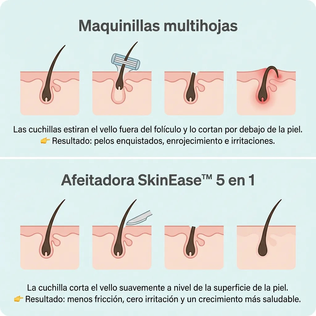 SkinEase™ – Maquinilla de afeitar 5 en 1