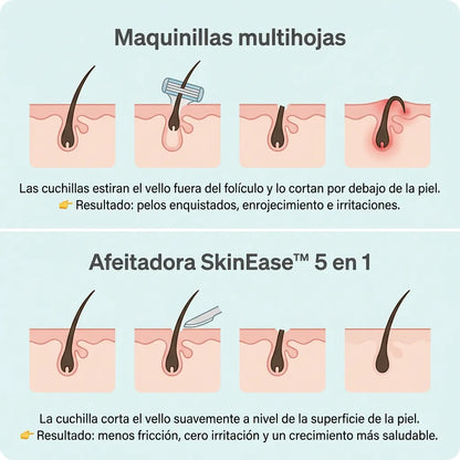 SkinEase™ – Maquinilla de afeitar 5 en 1